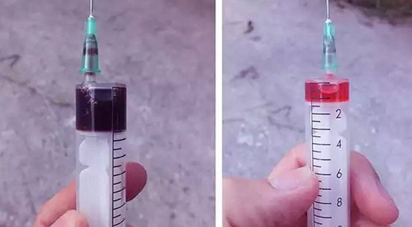 Какую жидкость заливать для гидроусилителя руля и как это делать правильно?