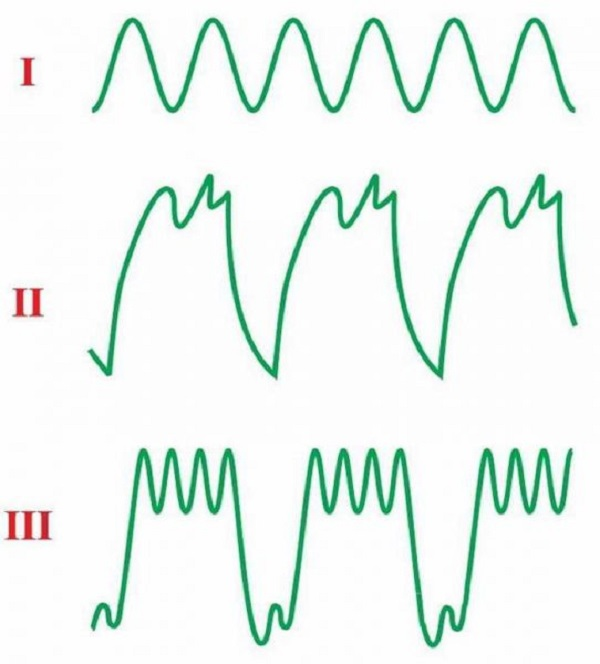 Неисправности генератора ВАЗ 2105 и их устранение Неисправности генератора ВАЗ 2105 и их устранение